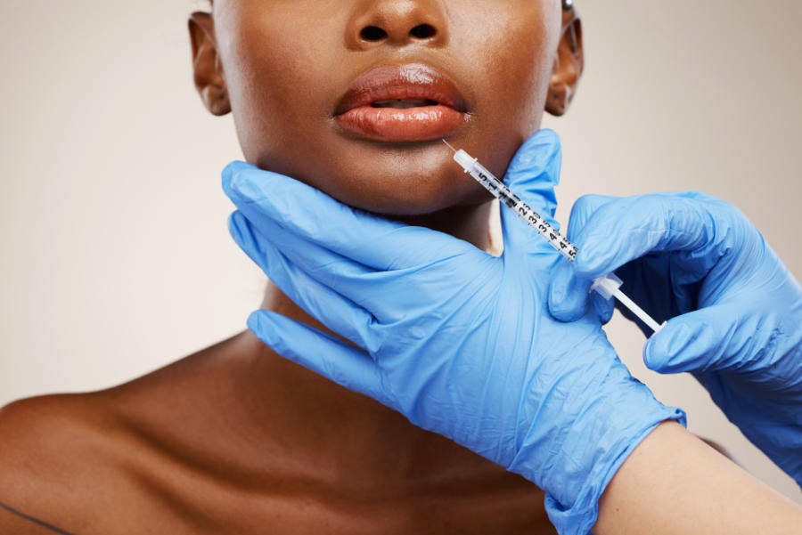 Dermal Fillers Treatment